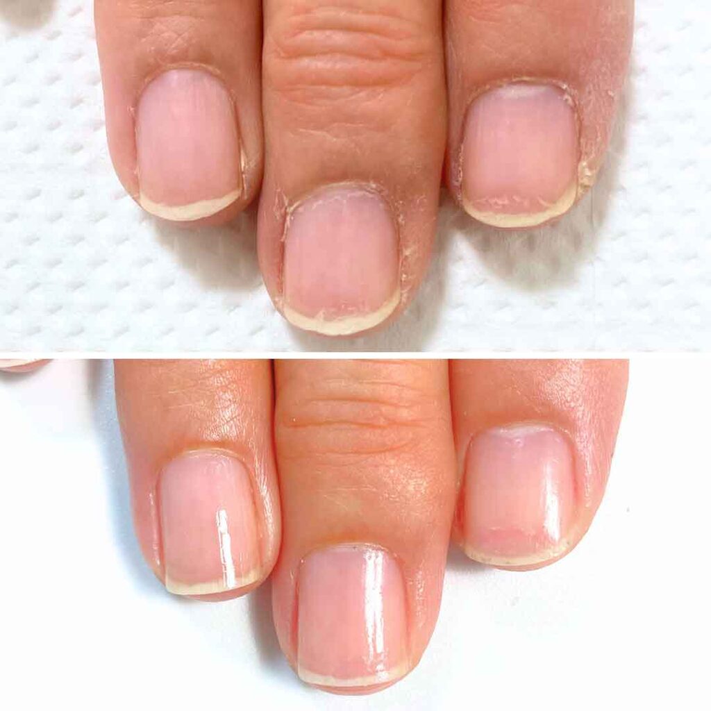 お悩み：縦筋 乾燥の症例写真3